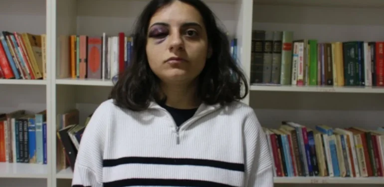 Edanur İbrahimoğlu’na Polis Şiddeti