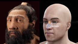 Uzun Burun Şekillerimiz Neandertallerden Miras Kalmış